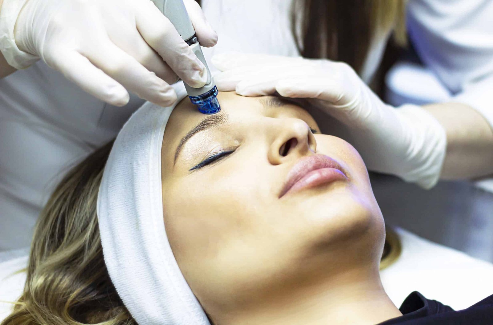 Chemical Peels | Absolute Health Care | Newnan GA