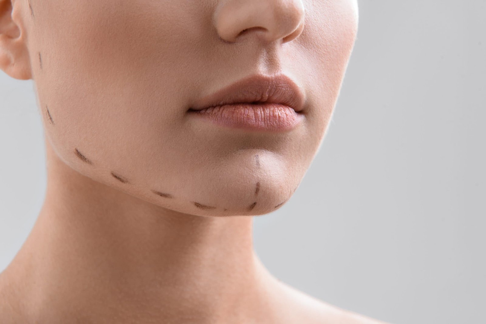Chemical Peels | Absolute Health Care | Newnan GA