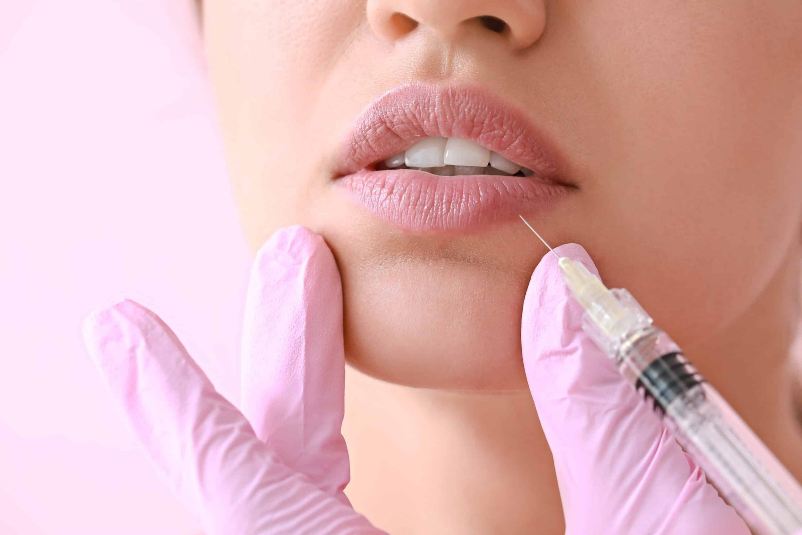 Dermal Fillers | Absolute Health Care | Newnan GA