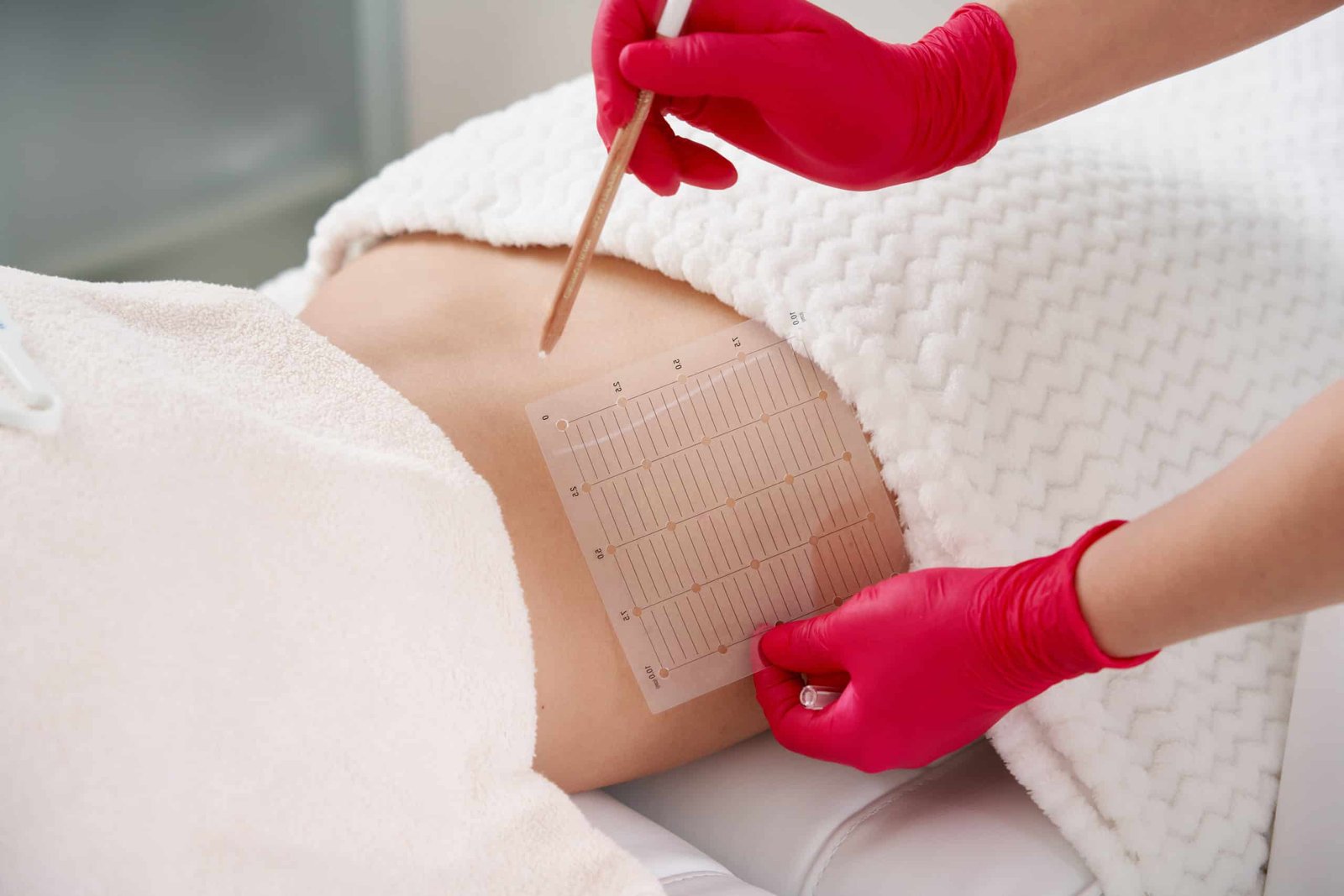 PRP/PRF Therapy | Absolute Health Care | Newnan GA