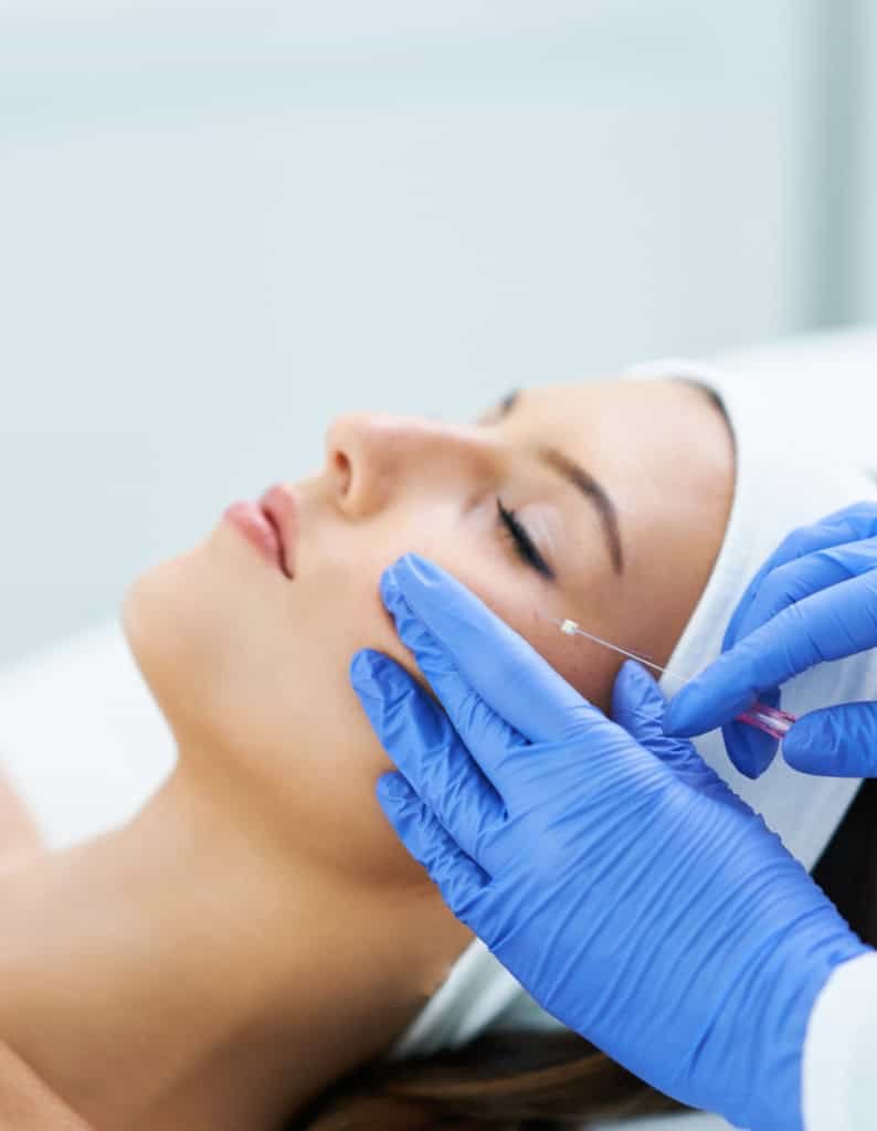 PDO Thread Lift | Newnan ,GA | Absolute Weight Loss & Wellness